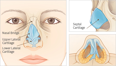 Deviated-nose-correction-nasal-septum-correction1