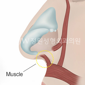 long-nose-correction-surgery-korea