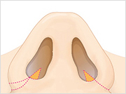 nose9_img5