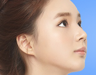 protruding-chin-surgery
